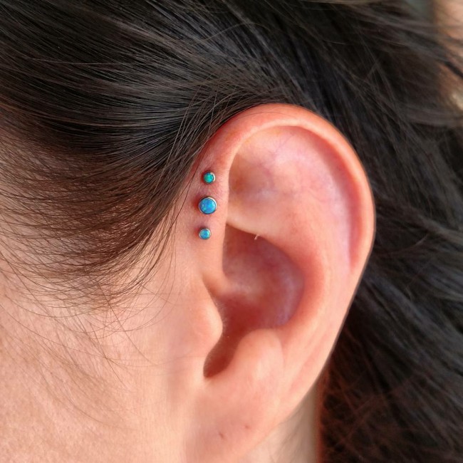 forward helix piercing infection