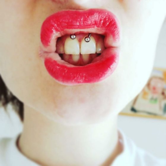 Smiley Piercing [50 Ideas]: Pain Level, Healing Time, Cost, Experience ...