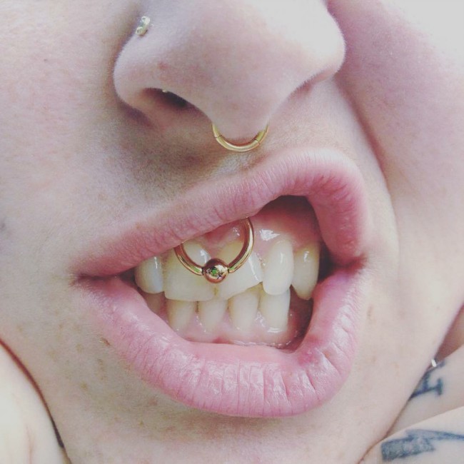 Smiley piercing: pain, healing, types of jewelry