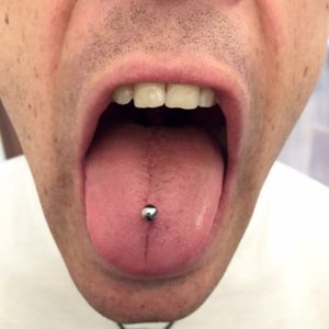 Tongue Piercing Types Chart