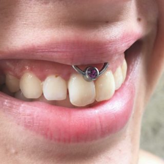Smiley Piercing [50 Ideas]: Pain Level, Healing Time, Cost, Experience ...