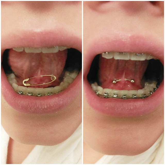 unusual tongue web piercing with braces