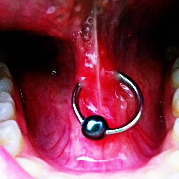 tongue webbing piercing with cbr