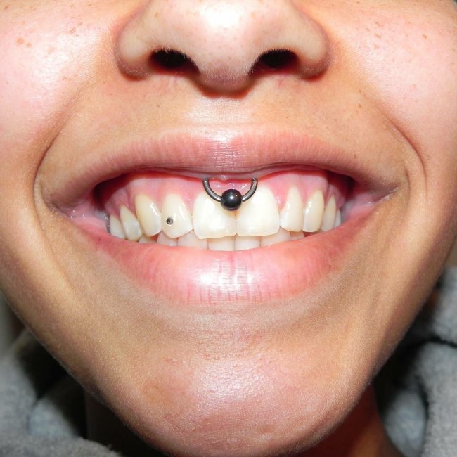 Smiley Piercing 