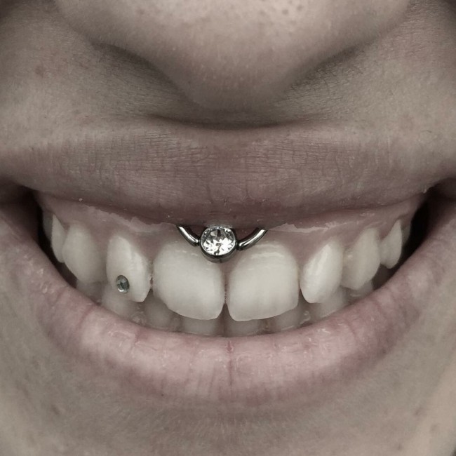 Smiley Piercing 50 Ideas Pain Level Healing Time Cost Experience Piercee
