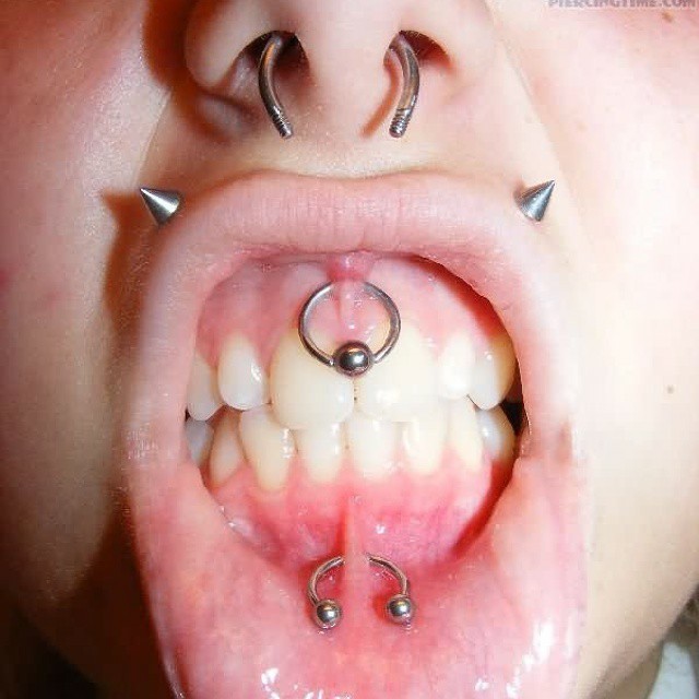 smiley and anti-smiley piercing image
