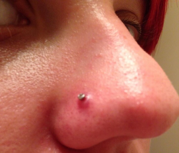 What do you do when sale your nose piercing is infected