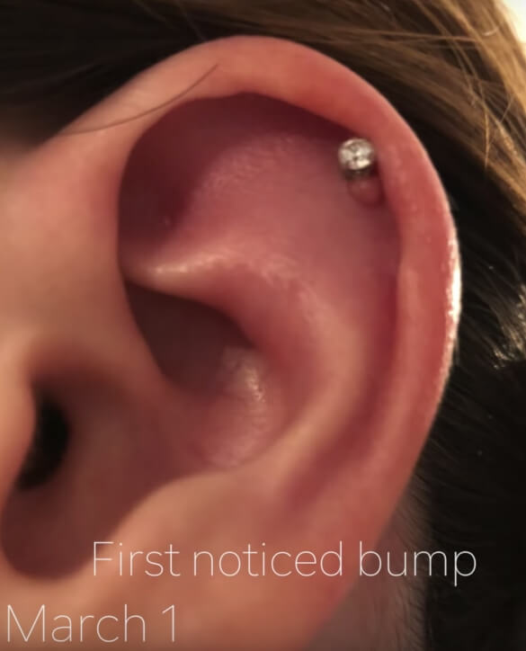 cartilage piercing bubble image