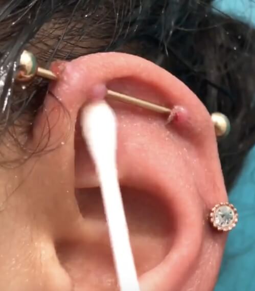 Salt water sale for earring infection