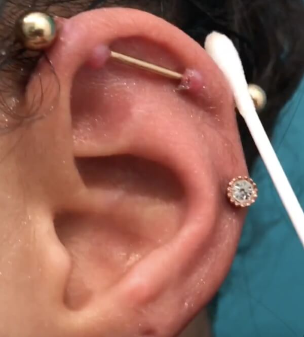 industrial piercing infection bump