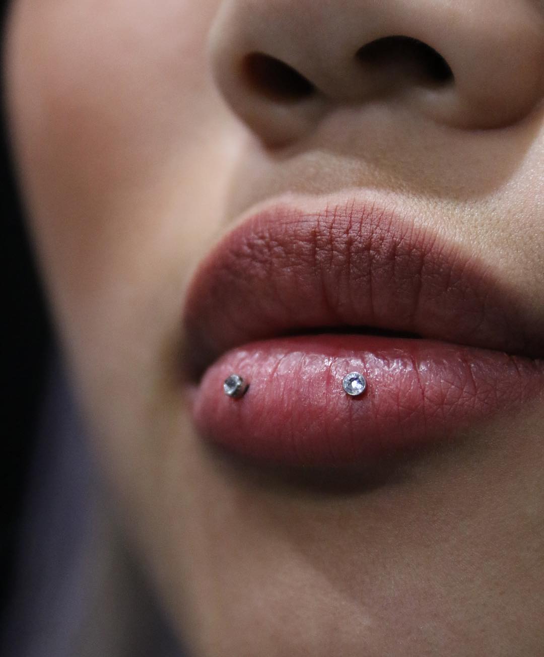 horizontal lip piercing scar