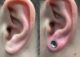 ear stretching before after