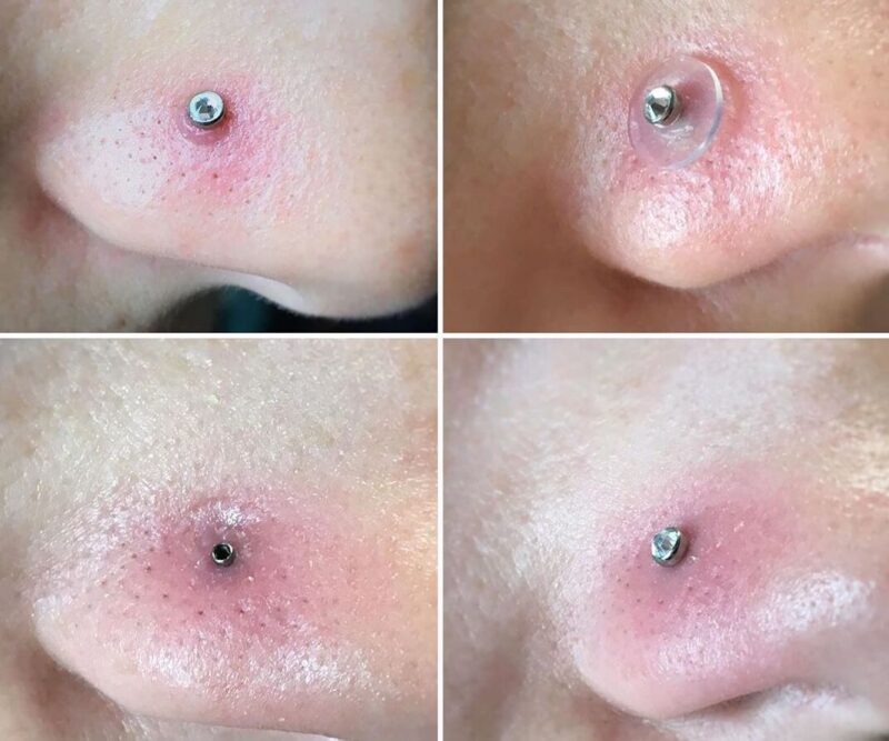 Ways to clearance heal nose piercing